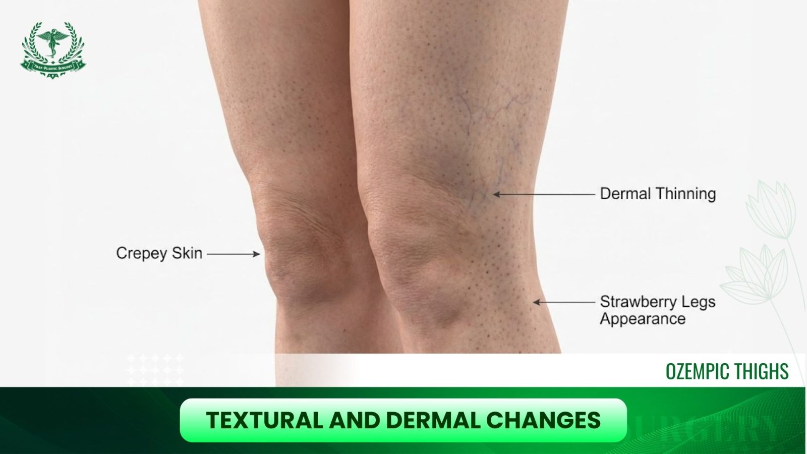 Textural and Dermal Changes