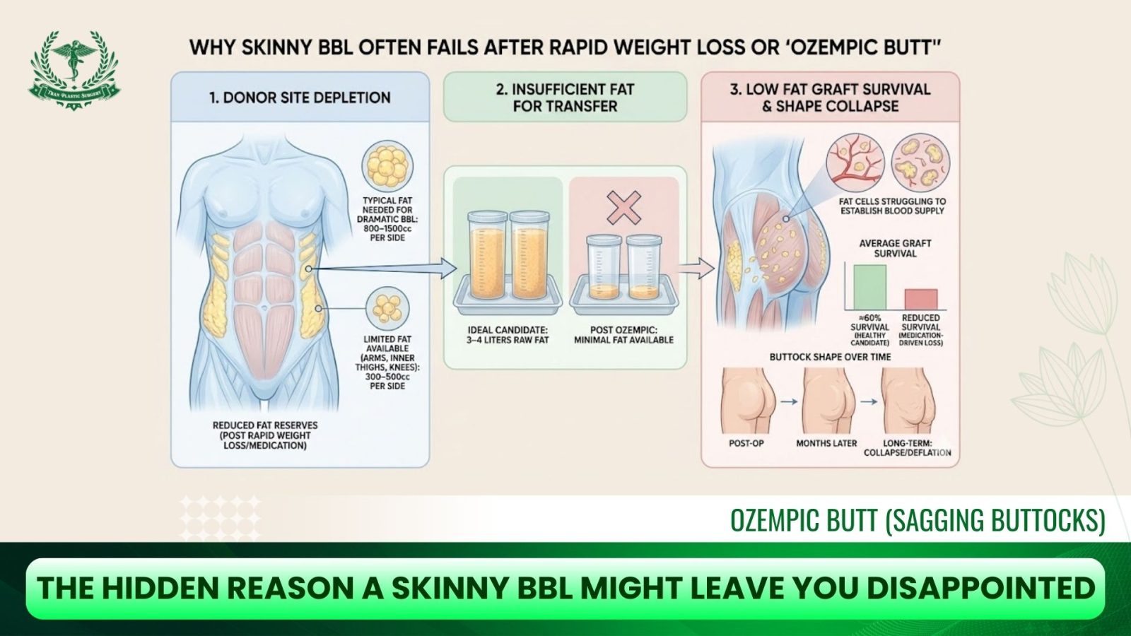 The Hidden Reason A Skinny BBL Might Leave You Disappointed