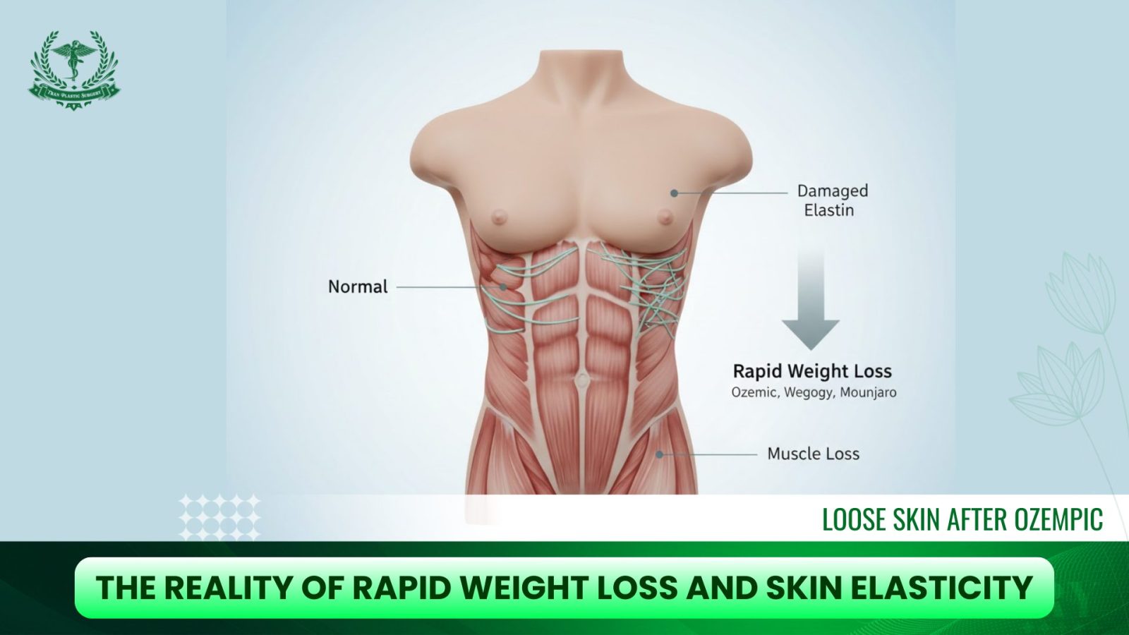 The Reality of Loose Skin After Ozempic and Weight Loss