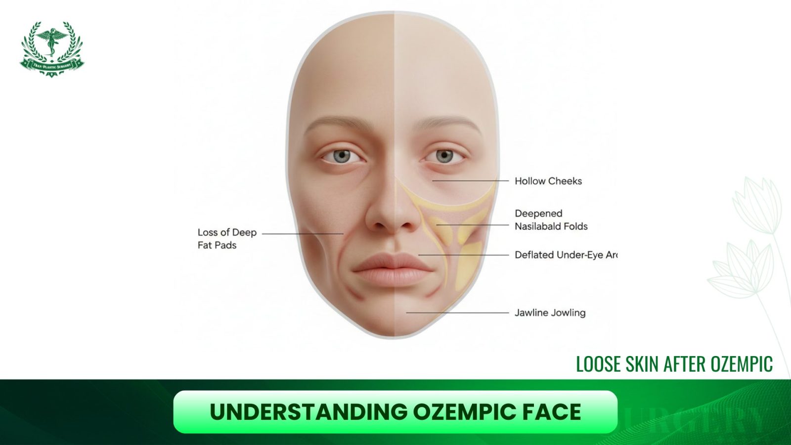 Understanding Ozempic Face