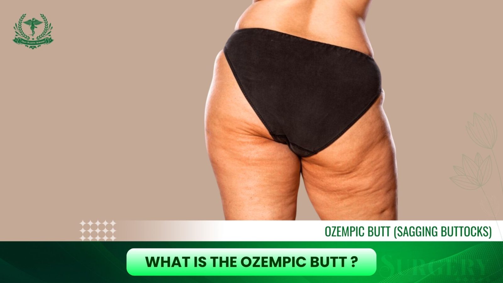 What Is The Ozempic Butt?