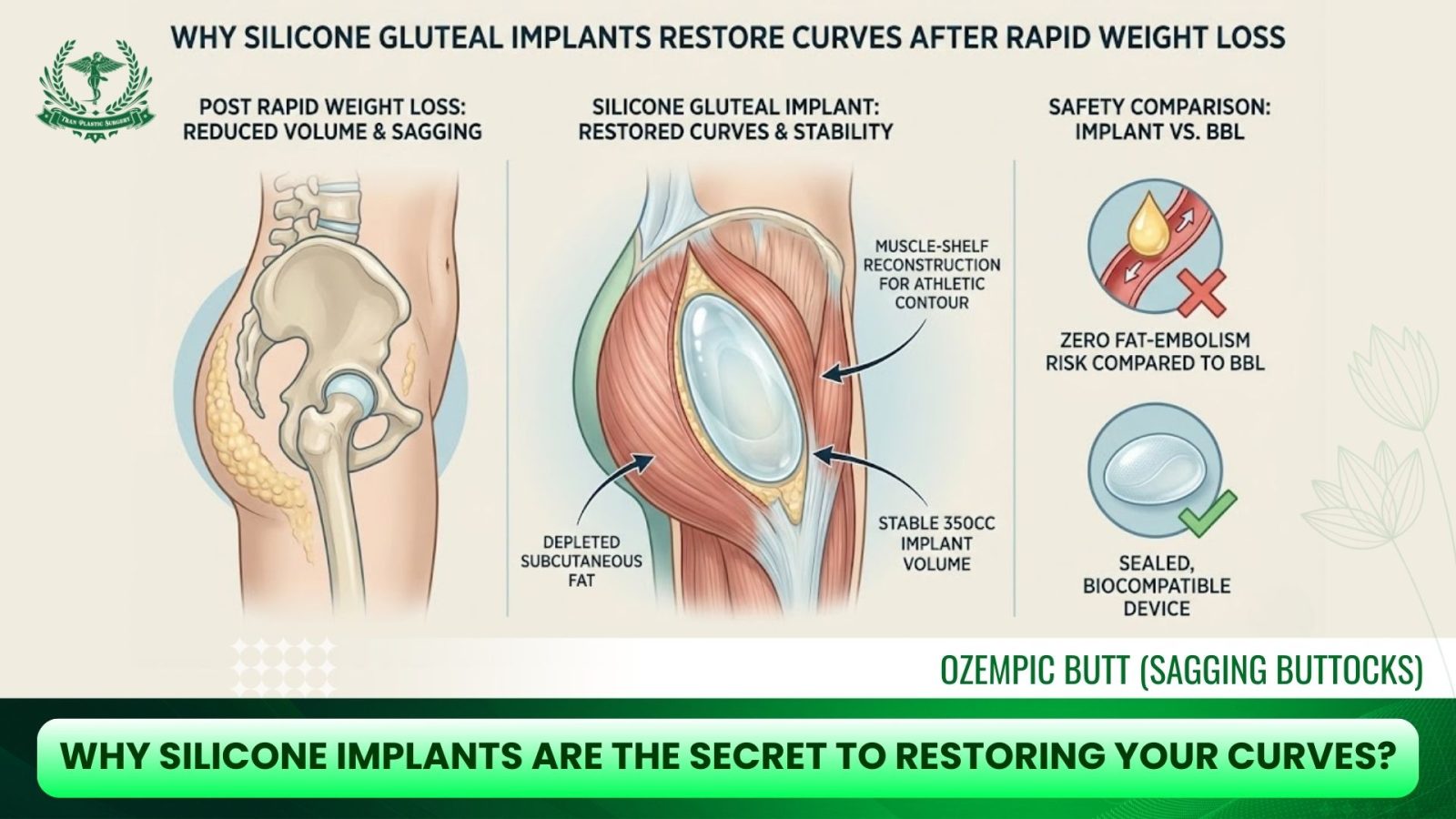 Why Silicone Implants Are The Secret To Restoring Your Curves?