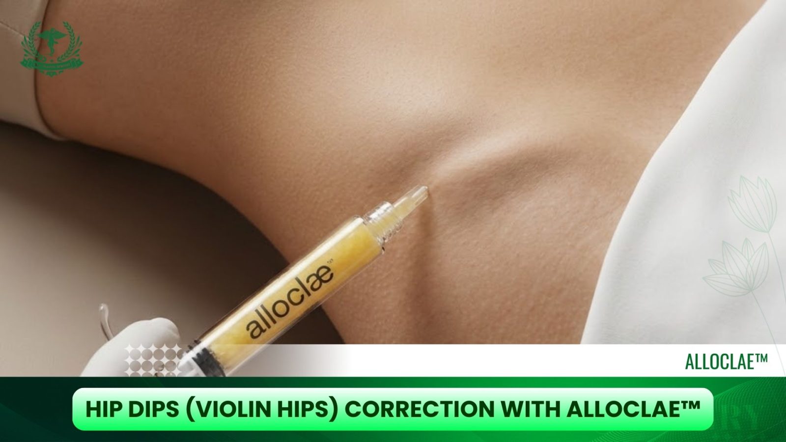 Hip Dips (Violin Hips) Correction with AlloClae™