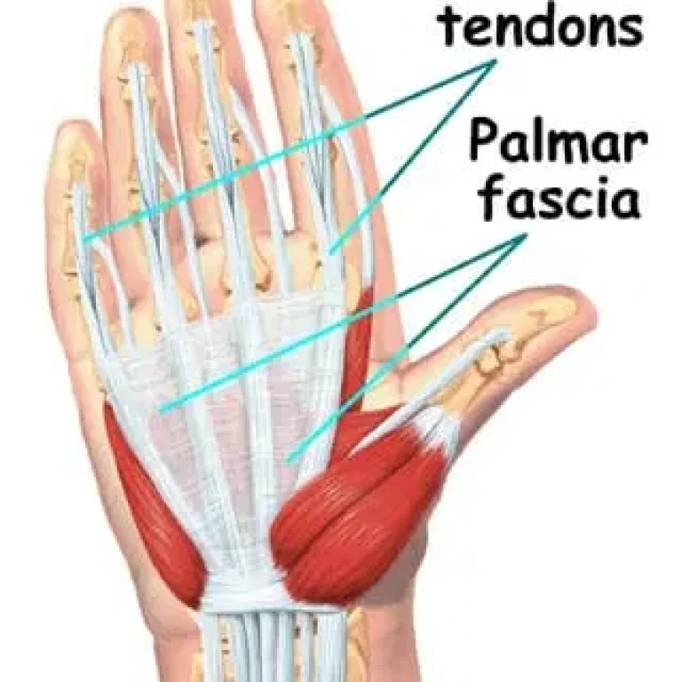 Flexor-Tendon