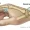 Ganglion