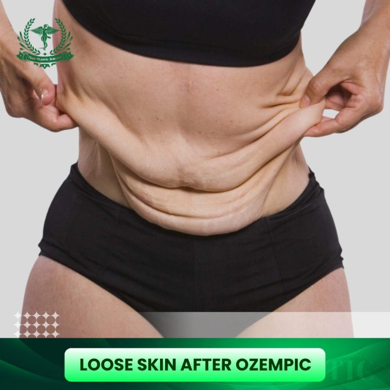 Loose Skin After Ozempic