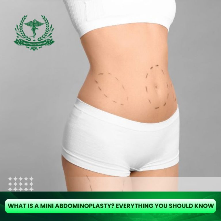 Mini Abdominoplasty