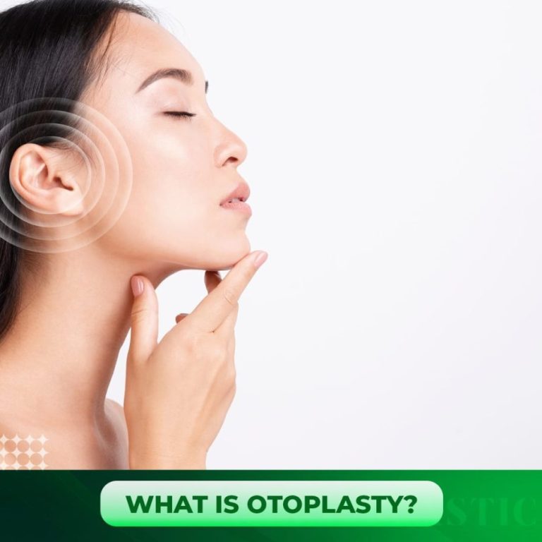 Otoplasty-01