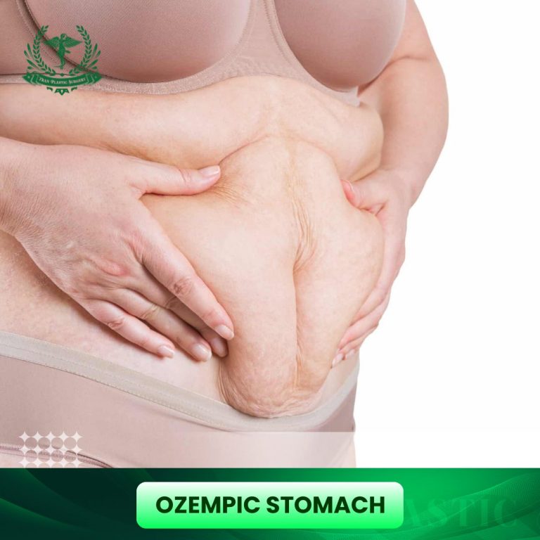 Ozempic Stomach