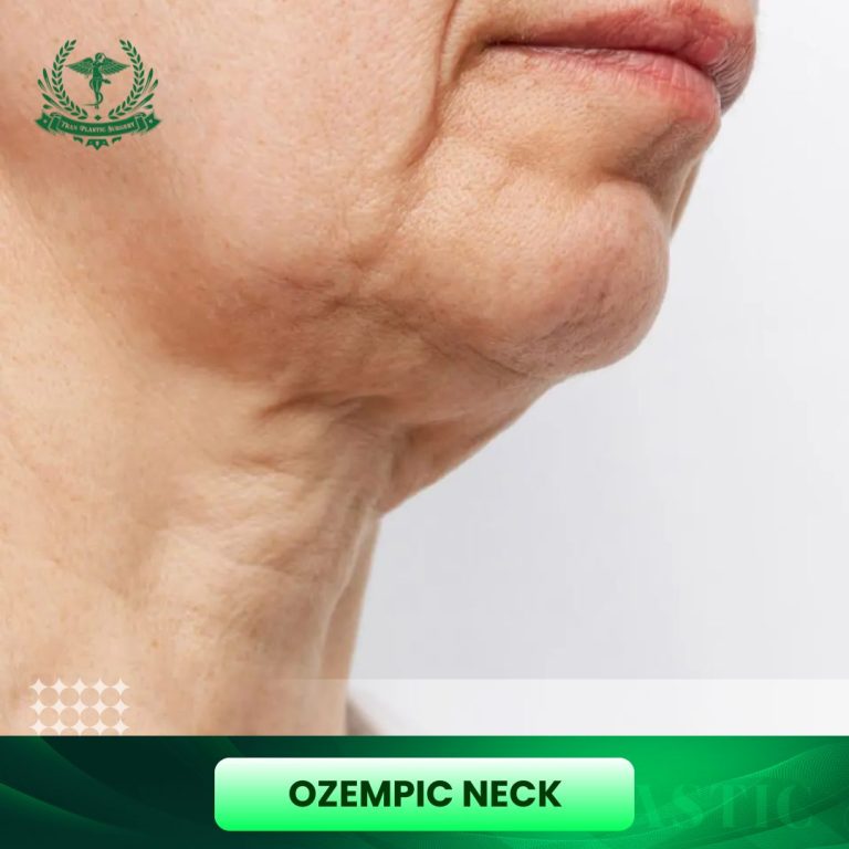 Ozempic neck