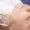 Radiofrequency Microneedling