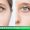 blepharoplasty-01