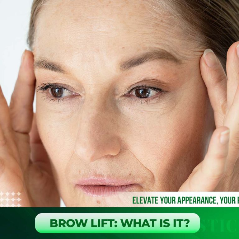 brow-lift-what-it-is