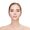 Cheek Recontouring
