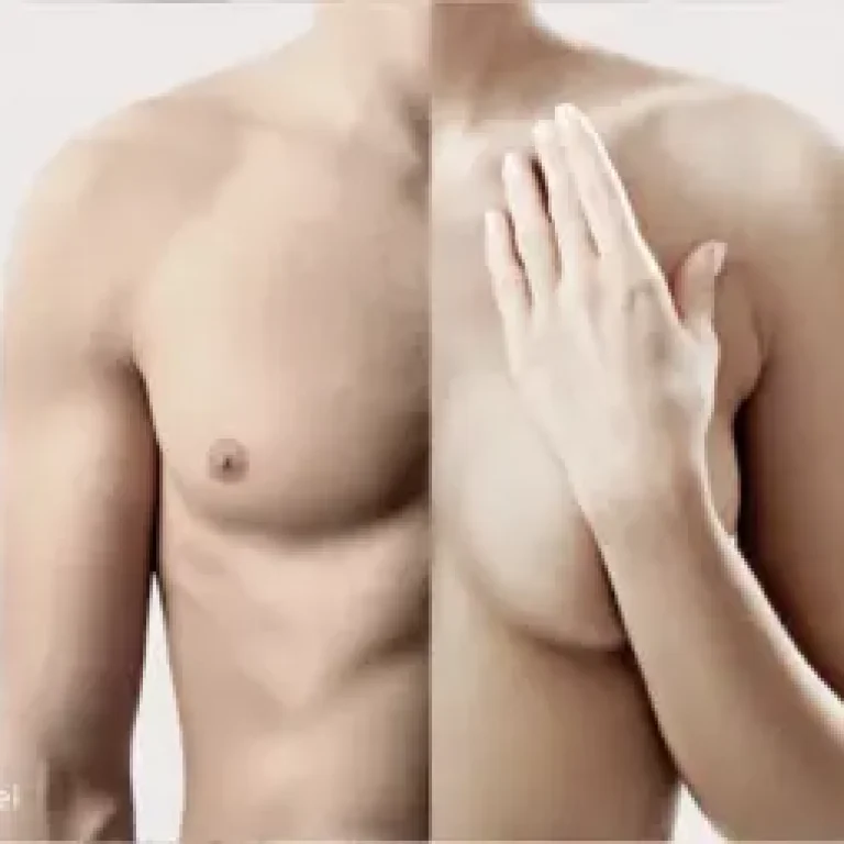 chest-reconstruction-2021-06-03-at-10.45.07-AM