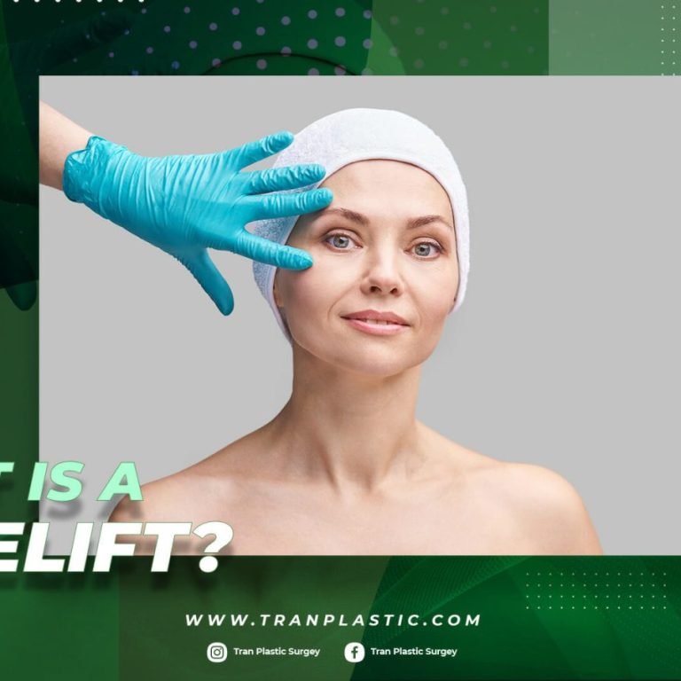 everything-you-need-to-know-about-facelift