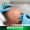 fue hair transplant